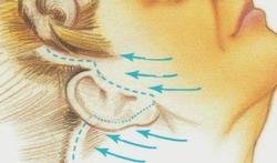 Traitement du visage aux fils Aptos