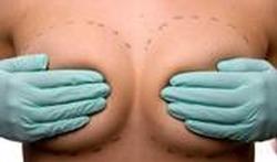 Augmentation mammaire