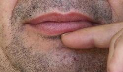 Une nouvelle bactérie dans la bouche
