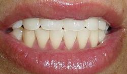 Pour un sourire plus blanc que blanc 