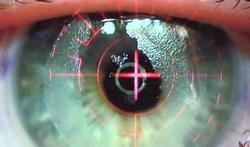 Chirurgie des yeux : l'opération au laser