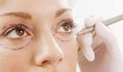 Correction des paupières ou blépharoplastie