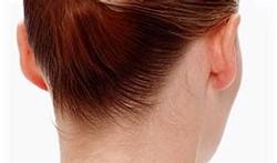 Otoplastie : Correction des oreilles décollées ou oreilles en feuille de chou